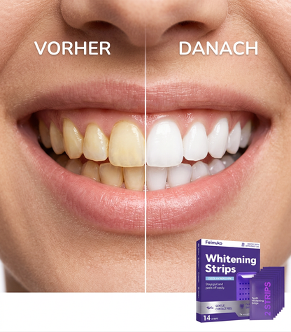 Weißes Lächeln – schon nach der ersten Anwendung | Feimuko Whitening Strips